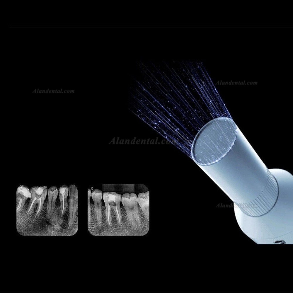 Woodpecker Ai Ray Dental Portable X-Ray Machine Imported High Frequency Tube